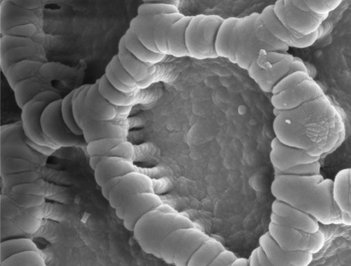 Mikrostruktur von Sporopollenin eines Pollenkorns