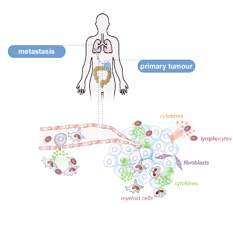 Tumour growth is influenced by cells of the innate and adaptive immunity.