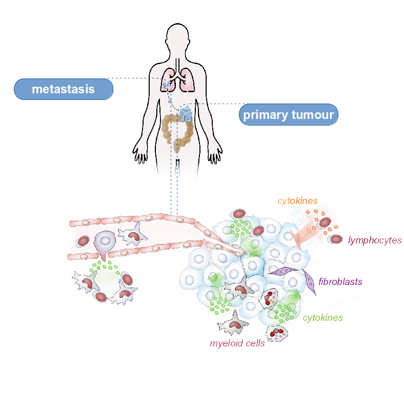 Tumorwachstum wird durch das Immunsystem reguliert.