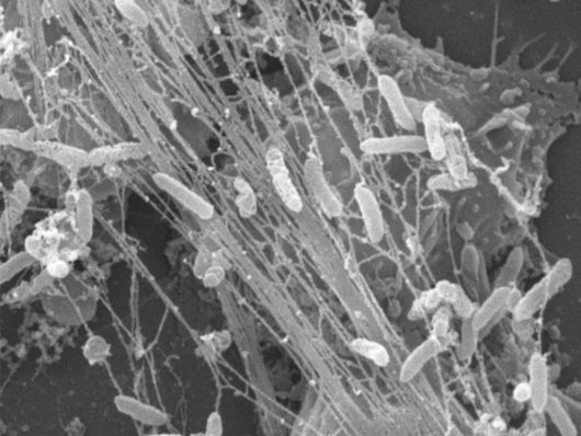 Foto: NETs mit Bakterien aus einem Laborexperiment (photographiert im Rasterelektronenmikroskop = REM) | © PLUS