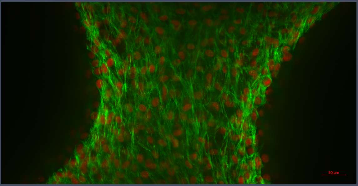 Capillary Bridge