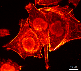 Heliobacter_Diechler_2024