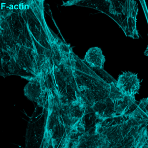 Human cytotoxic T cells were mixed with CD19-expressing cancer cells in the presence of a CD3–CD19 BiTE and then fixed. F-actin (cyan) and lysosomes (magenta) areshown. Notice how T cell lysosomes gather at the contact point, ready to deliver their cytotoxic payload
