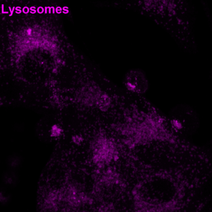 Human cytotoxic T cells were mixed with CD19-expressing cancer cells in the presence of a CD3–CD19 BiTE and then fixed. F-actin (cyan) and lysosomes (magenta) areshown. Notice how T cell lysosomes gather at the contact point, ready to deliver their cytotoxic payload