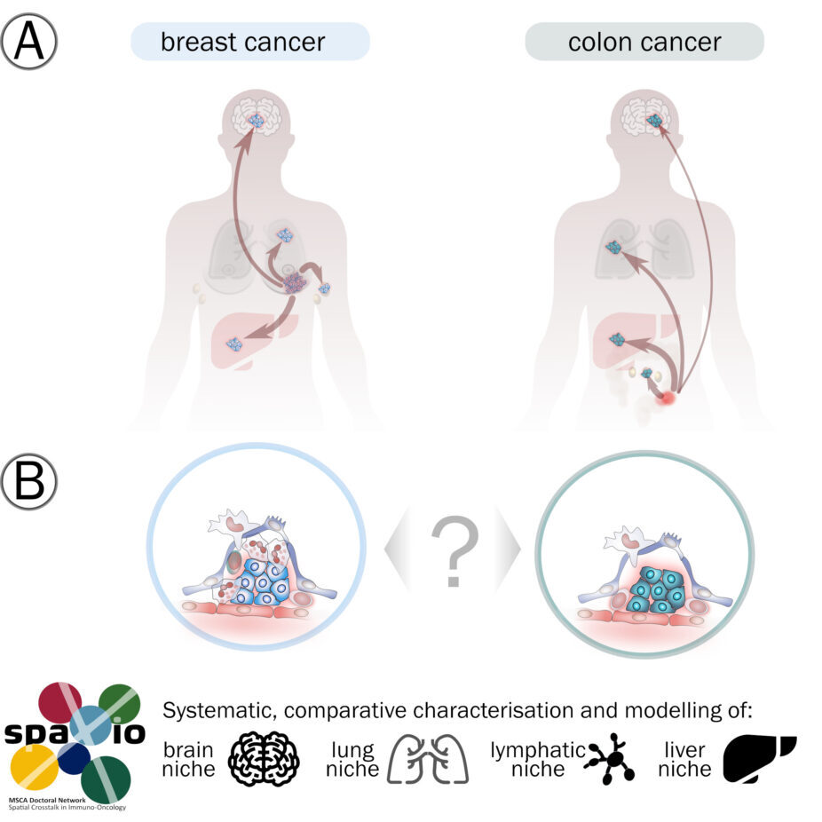 metastasis niche comparison in breast and colon cancer