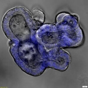 Colon Organoid